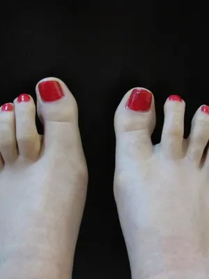 feetyfeet123 OnlyFans